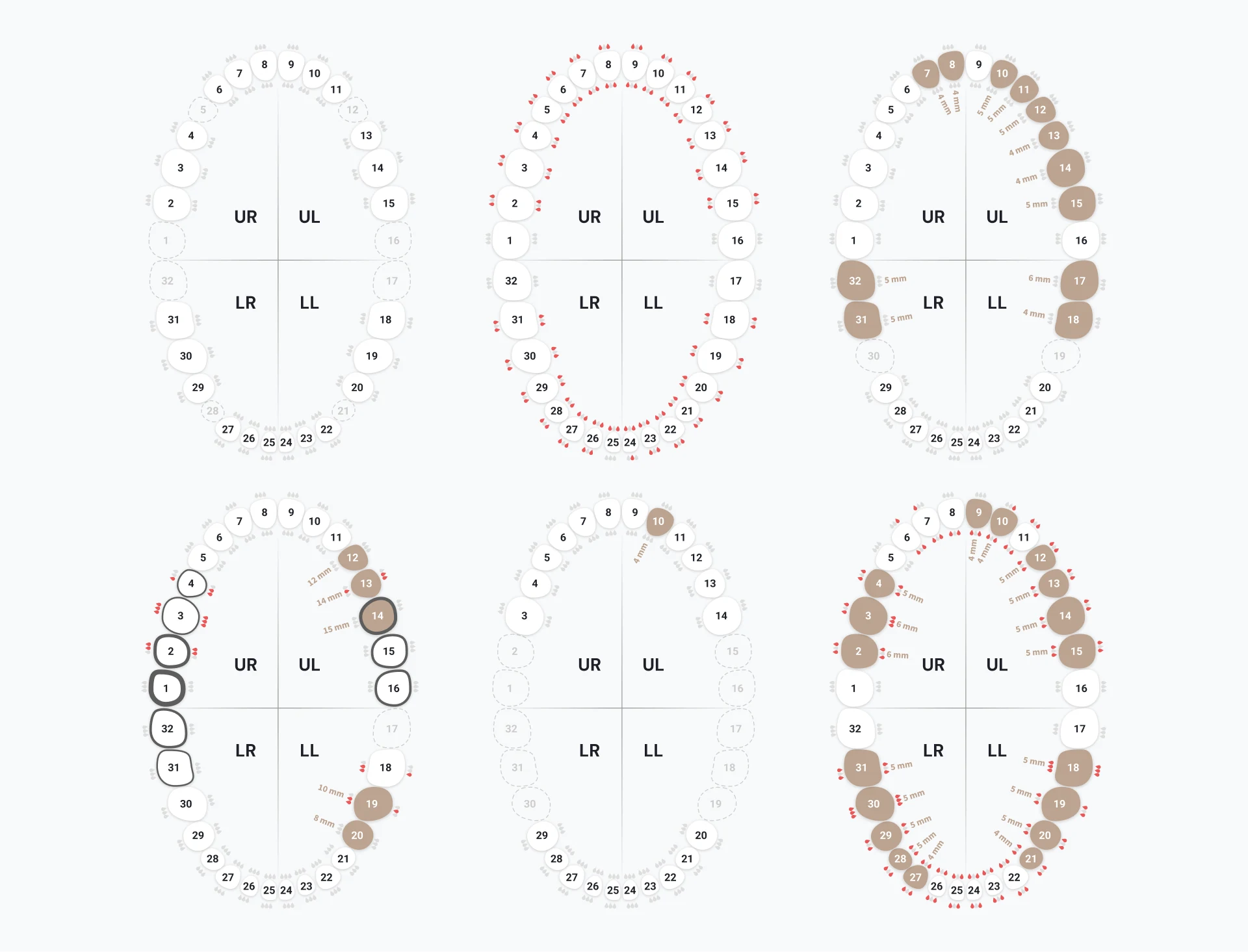 The same chart on real cases: missing teeth, bleeding, deep pockets, plaque, and their combinations